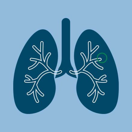 Chronic respiratory diseases
