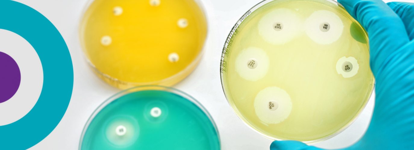 petri dishes showing antimicrobial resistance