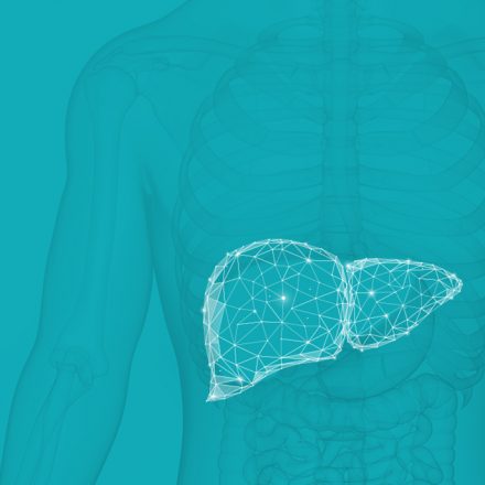 NASH Non-alcoholic steatohepatitis