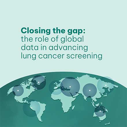 Lung Cancer Policy Network report explores the role of data in driving screening programmes