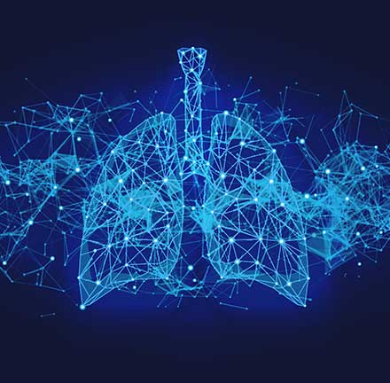 HPP and Lung Ambition Alliance highlight the cost of not implementing lung cancer screening in landmark report