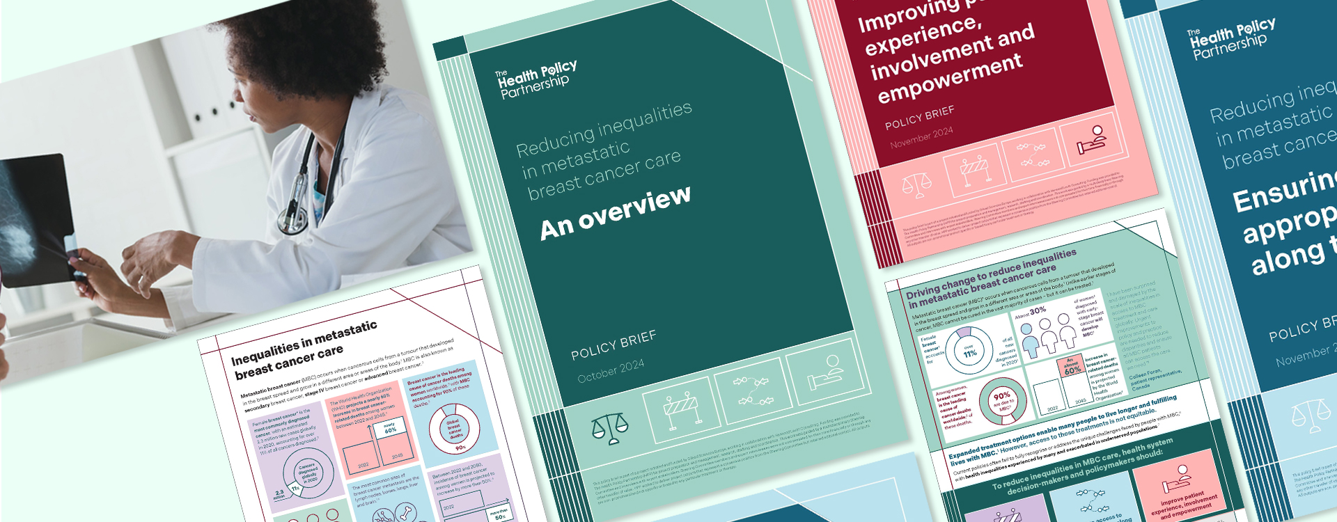 Metastatic breast cancer